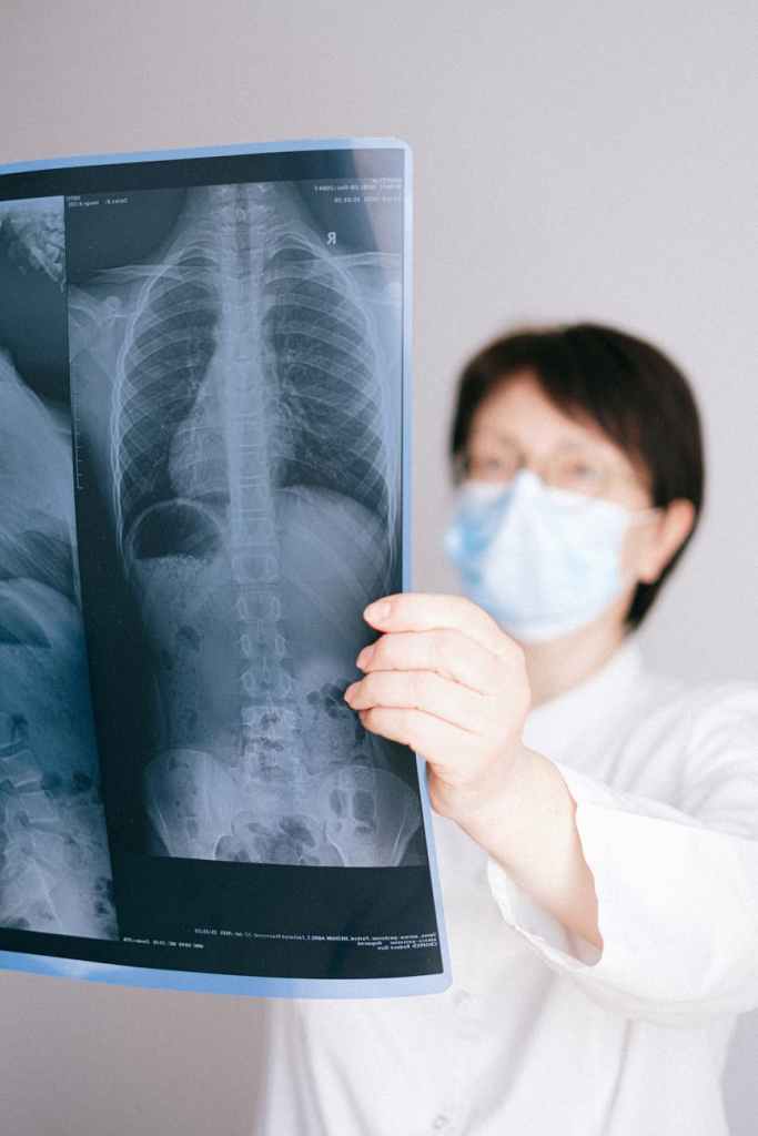 a doctor looking at an x ray result