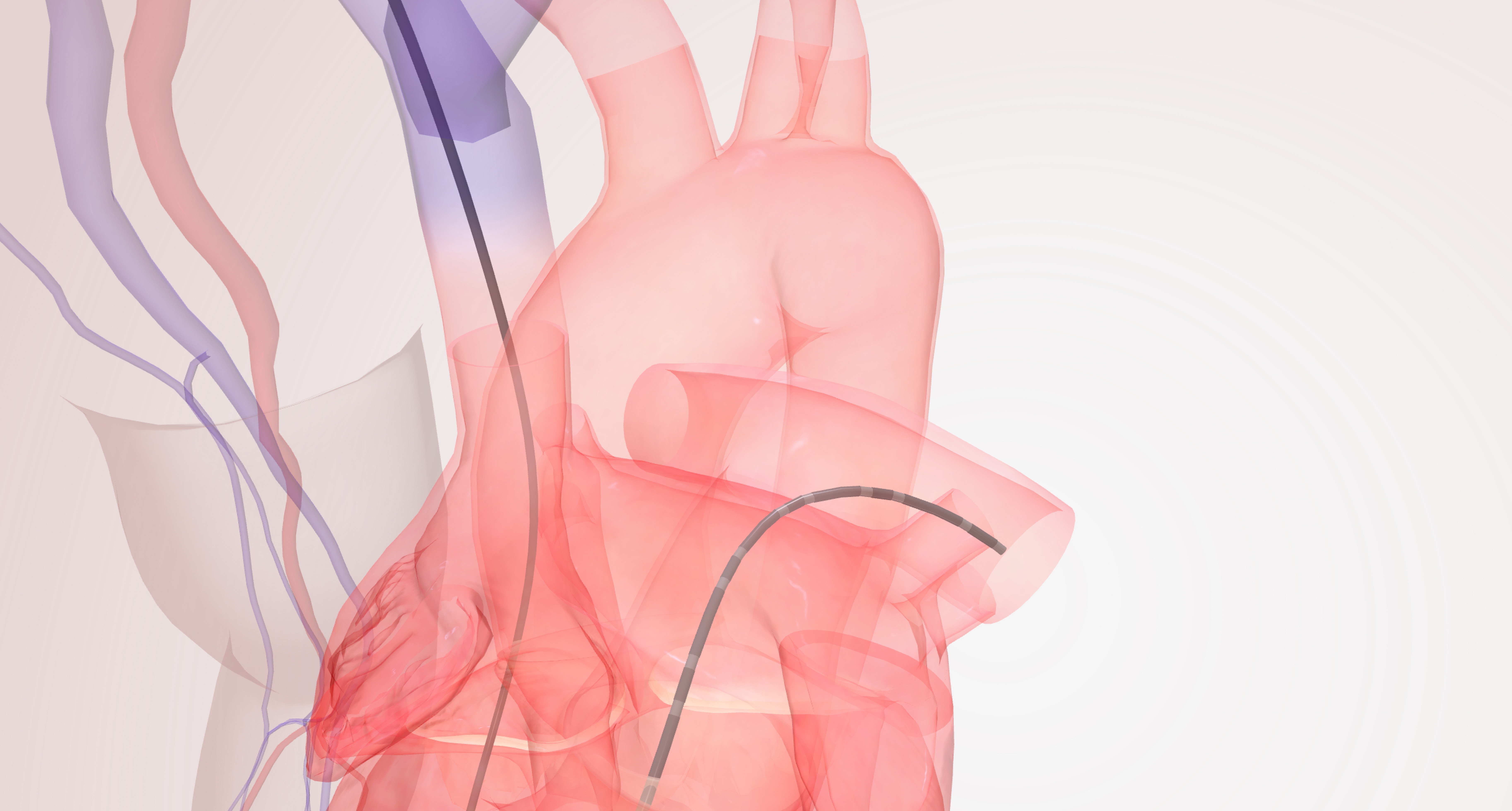 Photo inspiration: Visual Reference: The Acute Pulmonary Vasoreactivity In Pulmonary Arterial Hypertension