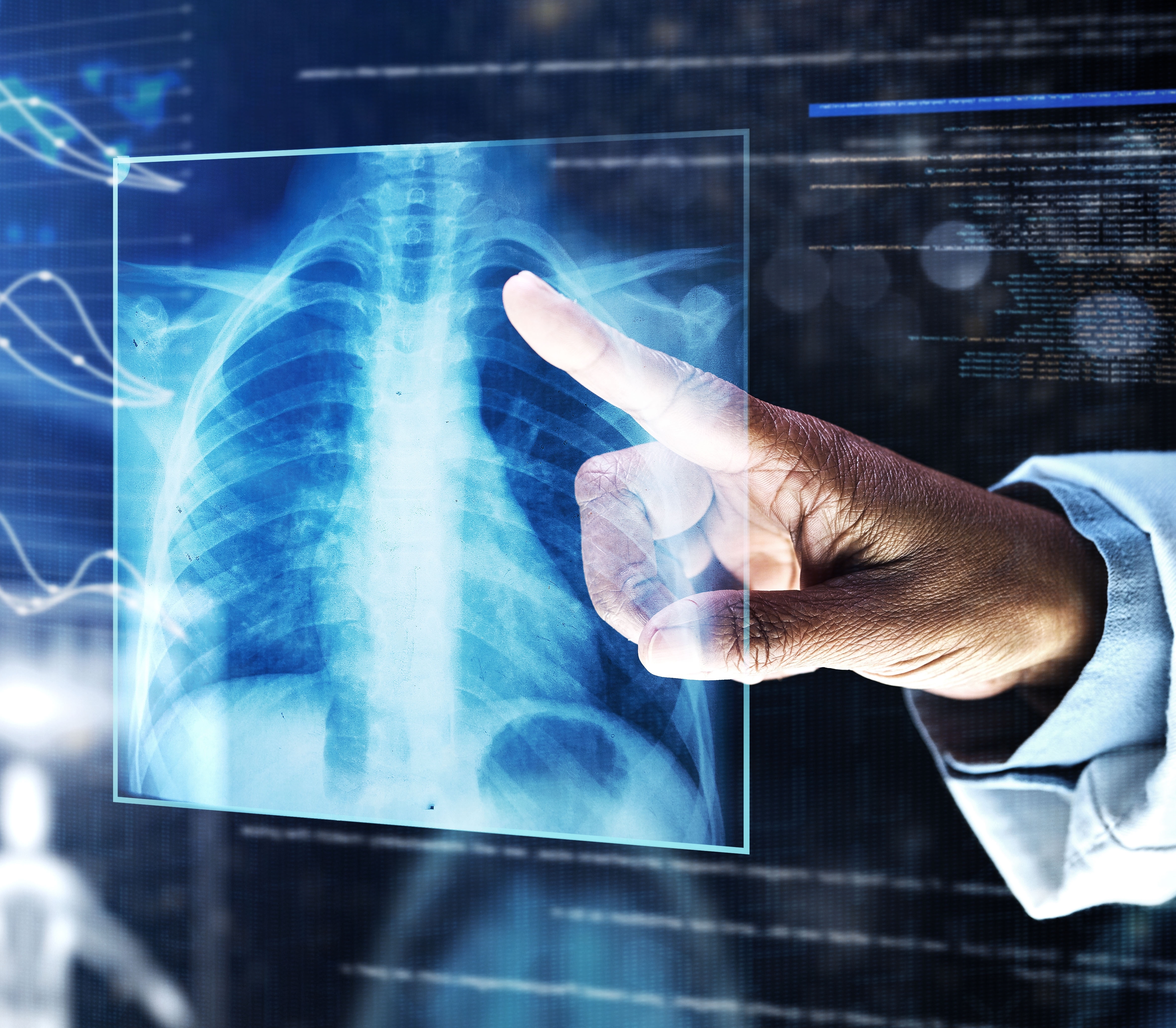 Pulmonary Hypertension associated with Interstitial Lung Disease (PH-ILD): State-of-the-Art Review, European Respiratory Journal, 2026